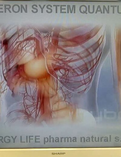 biorezonancia zilina mgr erika hanzlikova 4